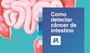 como detectar câncer de intestino