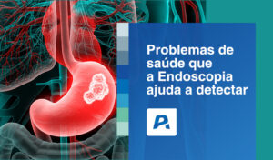 problemas de saúde que a endoscopia ajuda