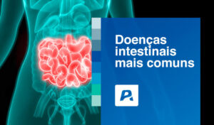 doenças intestinais mais comuns