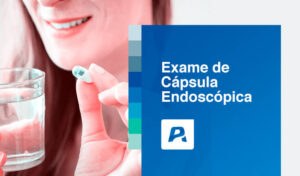 exame de cápsula endoscopica